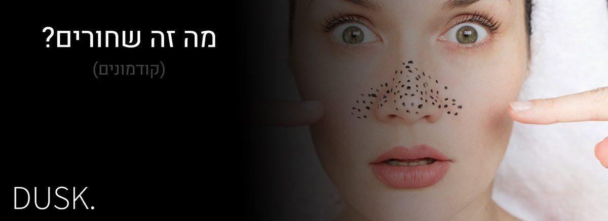 מה זה שחורים?