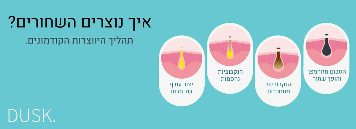 מה זה שחורים?